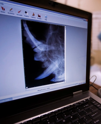 State-of-the-Art 3D Dental CT Imaging